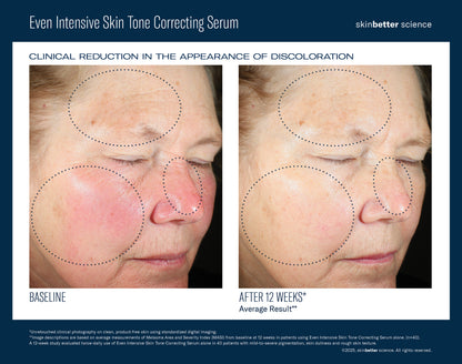 Even Intensive Skin Tone Correcting Serum 50ml