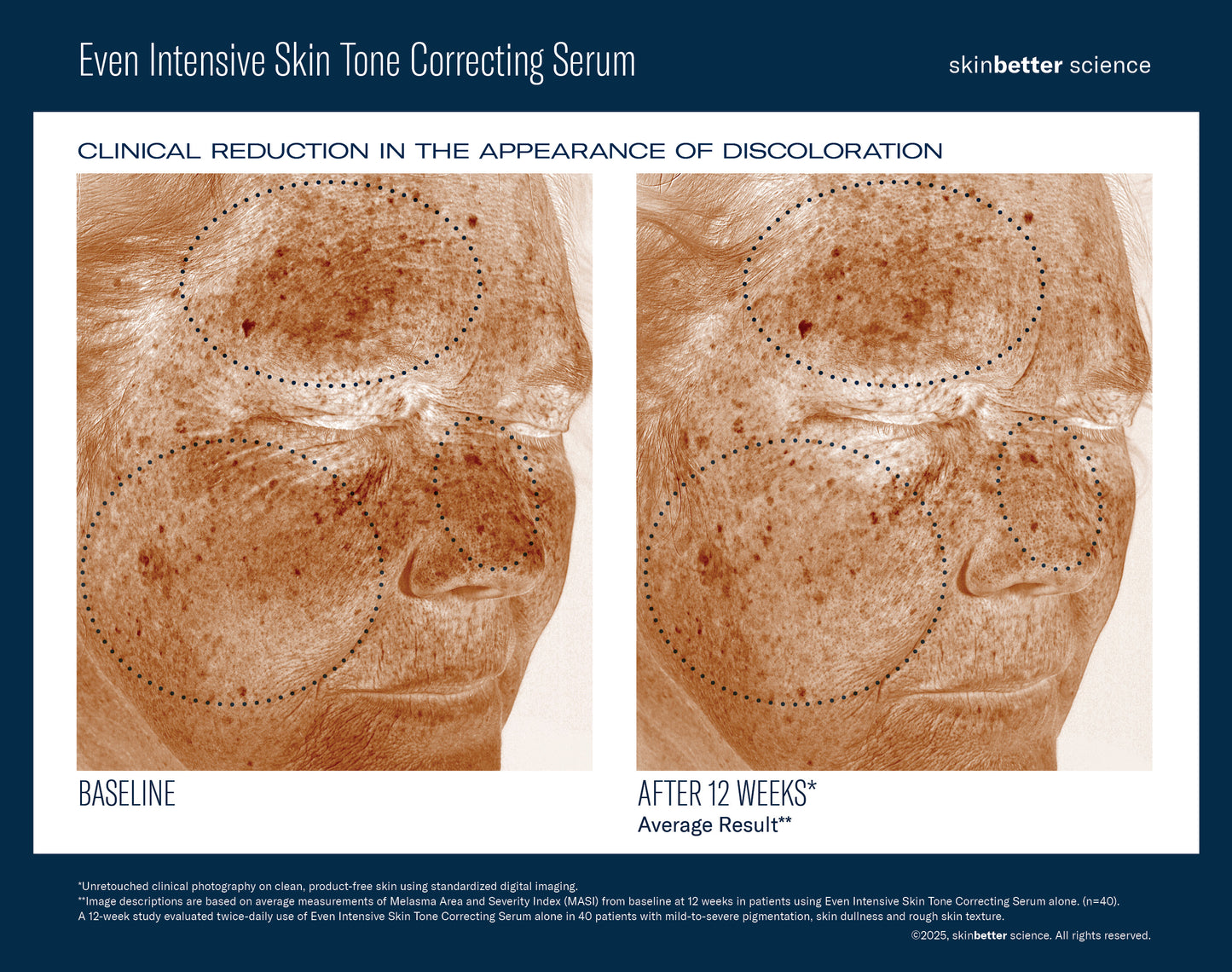 Even Intensive Skin Tone Correcting Serum 50ml
