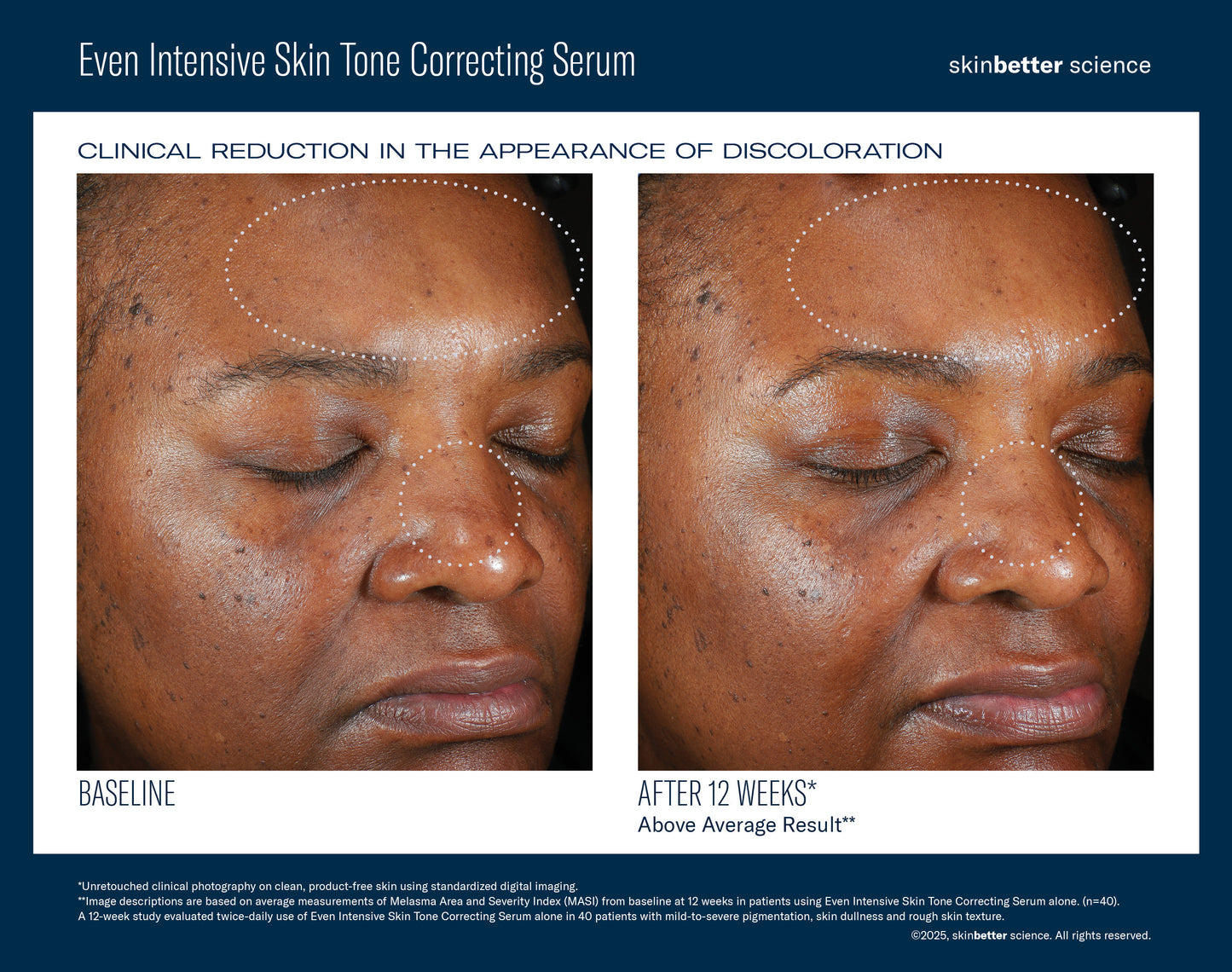 Even Intensive Skin Tone Correcting Serum 50ml
