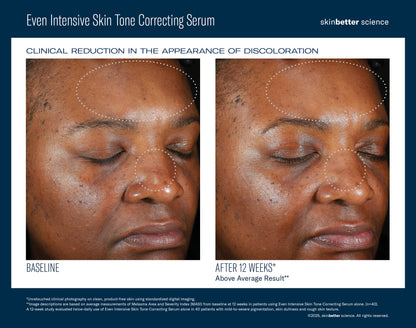 Even Intensive Skin Tone Correcting Serum 50ml