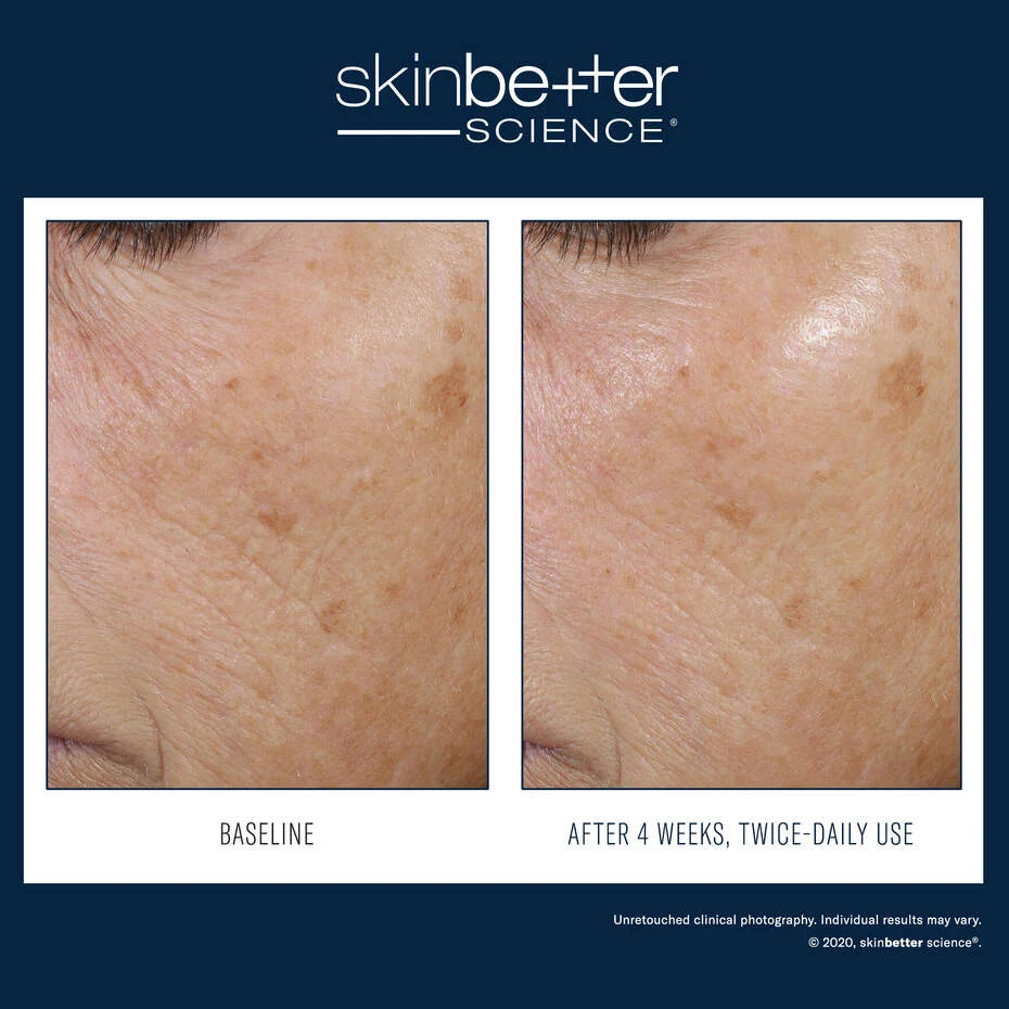 Trio Rebalancing Moisture Treatment