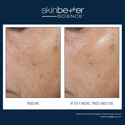 Trio Rebalancing Moisture Treatment